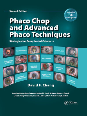 cover image of Phaco Chop and Advanced Phaco Techniques